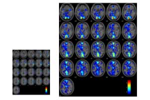 脳の血流量変化fMri